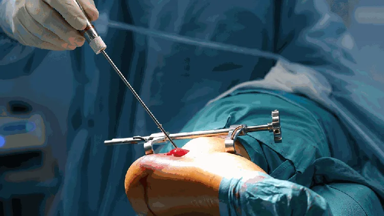 3. Minimally Invasive Vascular Surgery